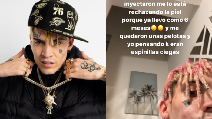 Marcianeke sufrió compleja reacción tras procedimiento estético: 