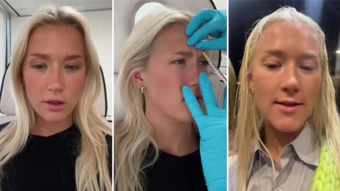 Vesta Lugg se cansó y sinceró todos sus procedimientos estéticos: 