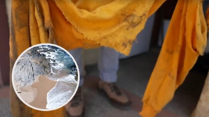 El impactante relato de mujer atacada por jauría de perros en la playa de El Tabo