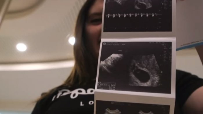 Método ROPA: La nueva maternidad en mujeres con embarazos compartidos