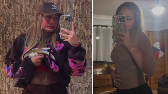 Skarleth Labra mostró el antes y después de su liposucción a horas de volver a Gran Hermano