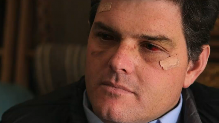 Detienen a seis personas que habrían participado en violento asalto a alcalde de Zapallar