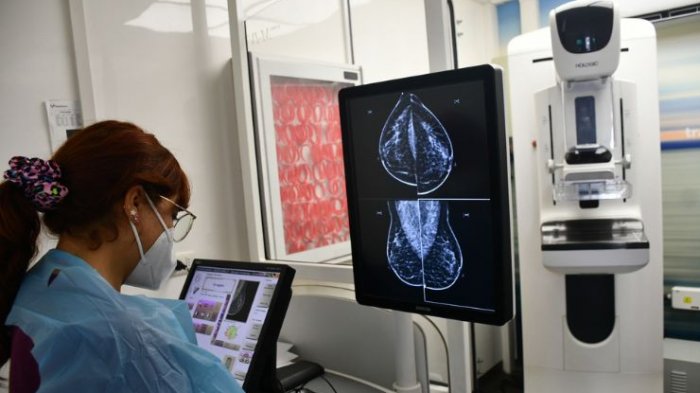 Cáncer de mama: Conoce los factores de riesgo en hombres y mujeres