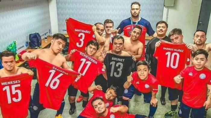 Selección chilena de talla baja fue agredida en Argentina: Jugador hasta perdió sus piezas dentales