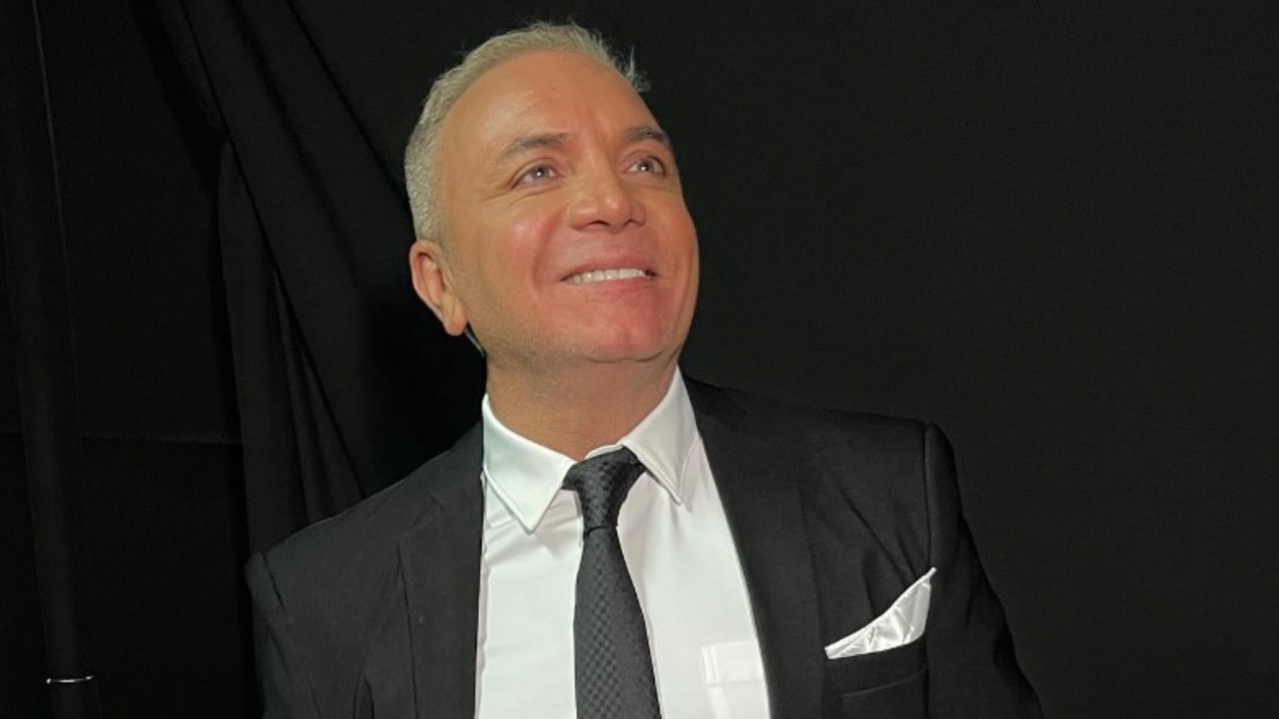 Luis Jara sorprendió con inesperado cambio de look Recibió curiosas