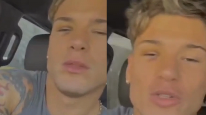 Raimundo Cerda reapareció con moretones en su cara y explicó la particular razón: “Voy a andar medio feo”