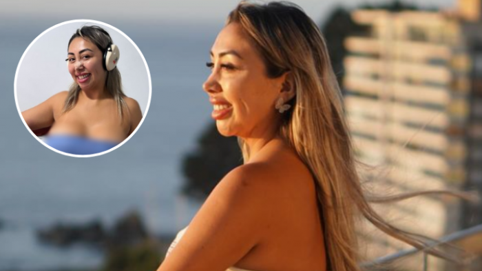 Naya Fácil mostró los resultados de su lipotransferencia a sólo 3 días de la intervención: 