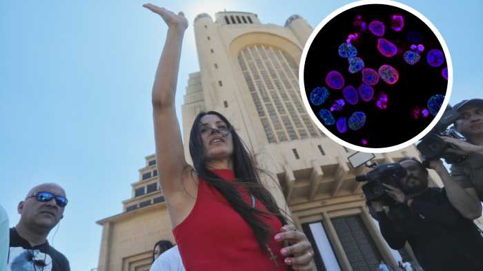 Leda Bergonzi aseguró que el cáncer se debe a la 