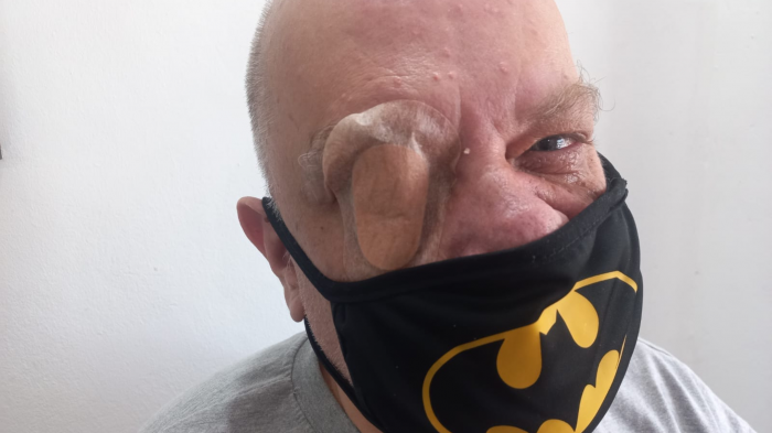 Roberto Nicolini habló tras sufrir ACV: 