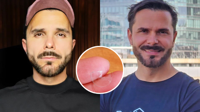 Álvaro Ballero reveló complejo momento por rotura de lente: 