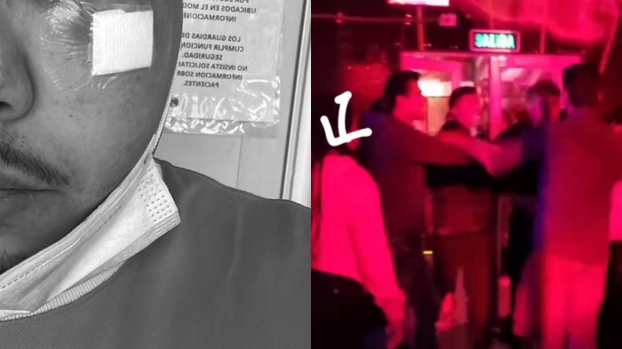 Artista urbano remeció con denuncia de brutal golpiza en conocida disco de Santiago: Reveló video clave
