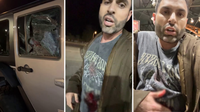 Estilista Jean Bohus fue apuñalado en Chicureo tras sufrir robo de su vehículo