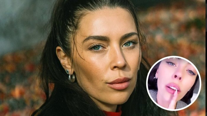 Daniela Aránguiz explicó nuevo procedimiento estético que se hizo para verse “como Angelina Jolie”