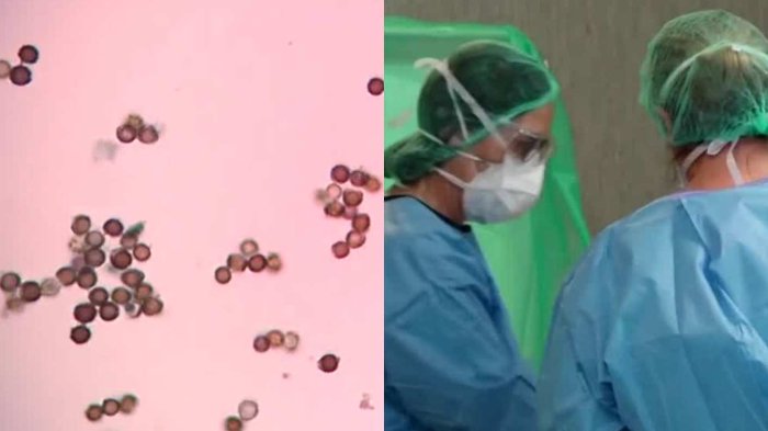 ¿A quiénes ataca el Streptococcus pyogenes? La llamada 