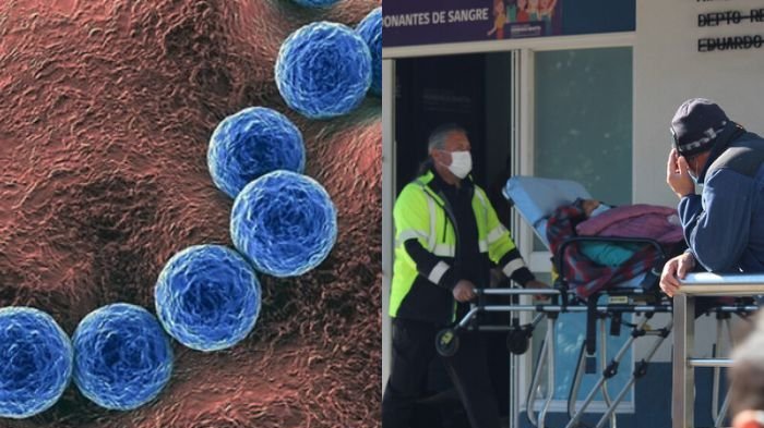 “Bacteria asesina”: Qué es el Streptococcus Pyogenes, sus síntomas y las infecciones graves