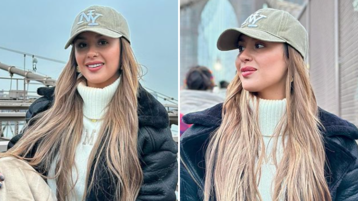 Azzartt Maveth impactó al mostrar los resultados de su intervención estética: “Quedé como yo quería”