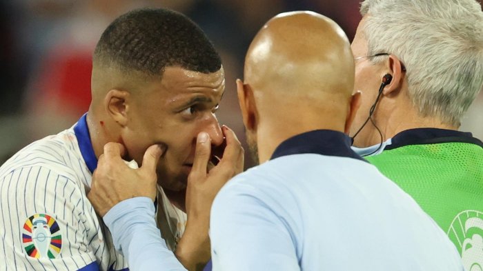 Impactante: El brutal choque de Kylian Mbappé que le provocó fractura de nariz en plena Eurocopa