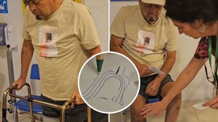 Mauricio Medina celebró instalación de su prótesis ortopédica en emotivo video