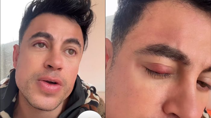 Bruno Zaretti preocupó al contar que se someterá a delicada operación: “No me va a ganar”