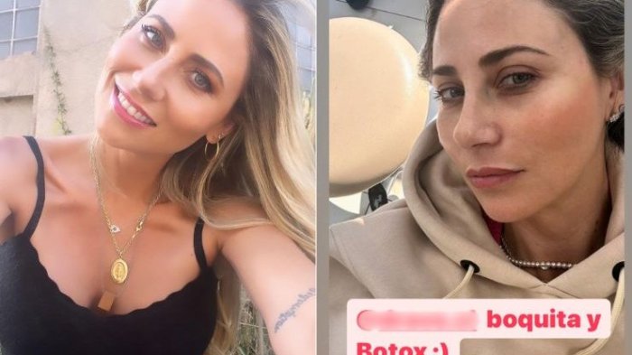 Gissella Gallardo mostró antes y después de intervención estética de su hija de 13 años