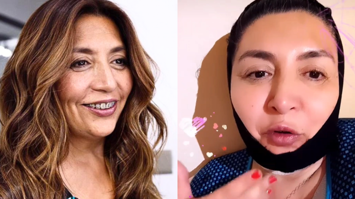 ¡Totalmente renovada! Pincoya impactó con atrevida intervención estética en su rostro