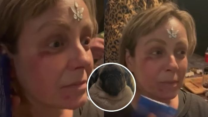 El doloroso accidente de Claudia Conserva en Fiestas Patrias: “Por salvarle la vida”