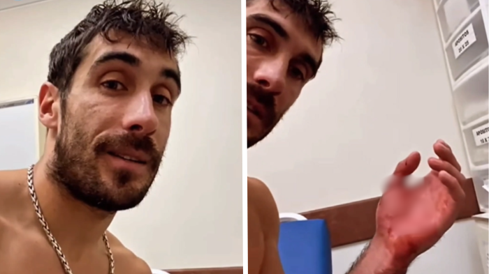 Pedro Astorga llegó a urgencias tras sufrir feo accidente en su kayak: Estará varios días en reposo