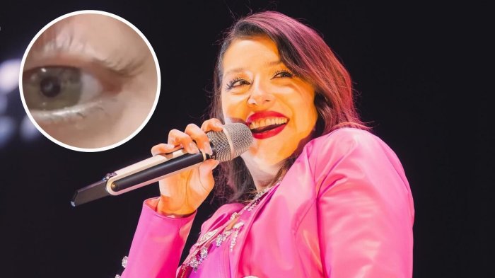 “Tengo un pelón”: María José Quintanilla reveló compleja afección a la piel