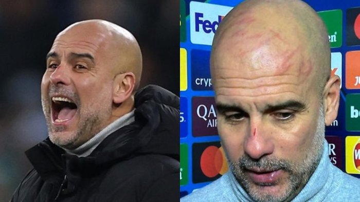 Guardiola aclara sus heridas en la cabeza tras empate del Manchester City en Champions: “Me pillaron”