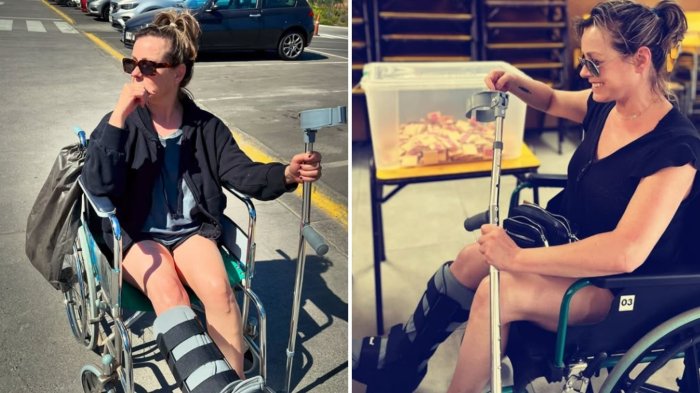 “No es un drama”: Claudia Conserva reveló detalles del accidente que la dejó caminando con muletas