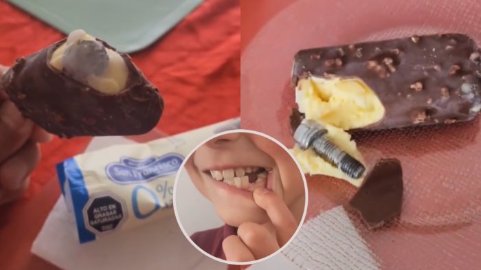 “Devuelve el diente”: Denuncian que venía un tornillo dentro de un helado