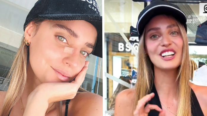 Trinidad de la Noi se sometió a cirugía por un cáncer de piel: “Nunca me afligí”