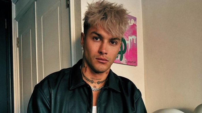 Nicolás Solabarrieta sorprende con nuevo e impactante procedimiento estético