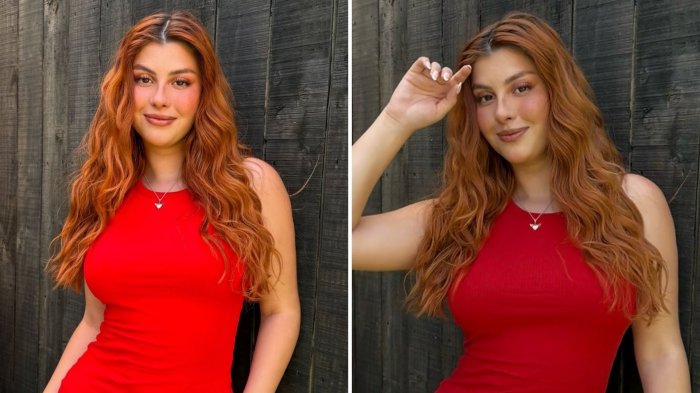 “La saqué barata”: Mafe Bertero sufrió grave accidente y terminó con puntos de sutura