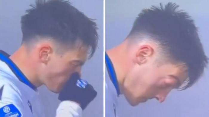 Jugador sufrió impactante lesión ocular tras sonarse la nariz durante partido de fútbol