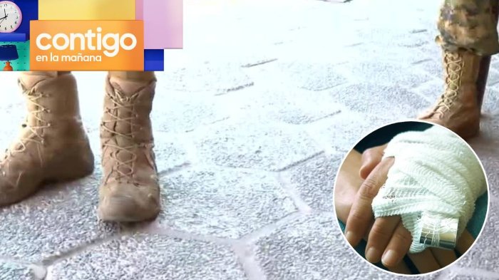 Mujer denuncia brutal golpiza de su marido que es Mayor de Ejército: Está escondida junto a sus hijos