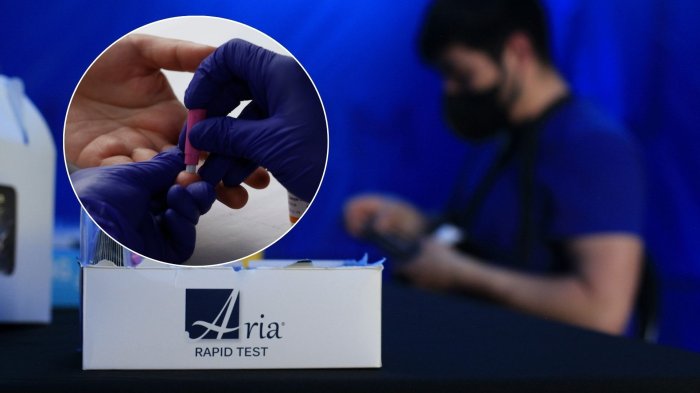 Conoce ACÁ cómo y dónde realizar el test rápido de VIH
