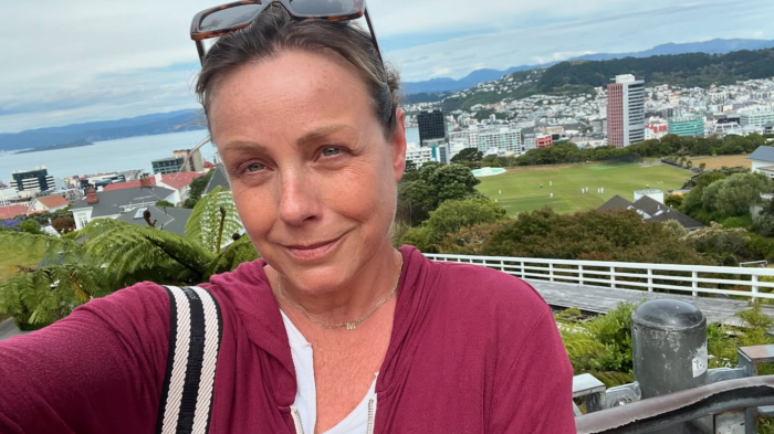 Claudia Conserva sorprende con nuevo look tras tratamiento de cáncer