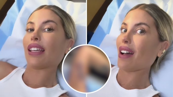 “Ni siquiera siento”: Cote López causó preocupación tras removerse significativo tatuaje