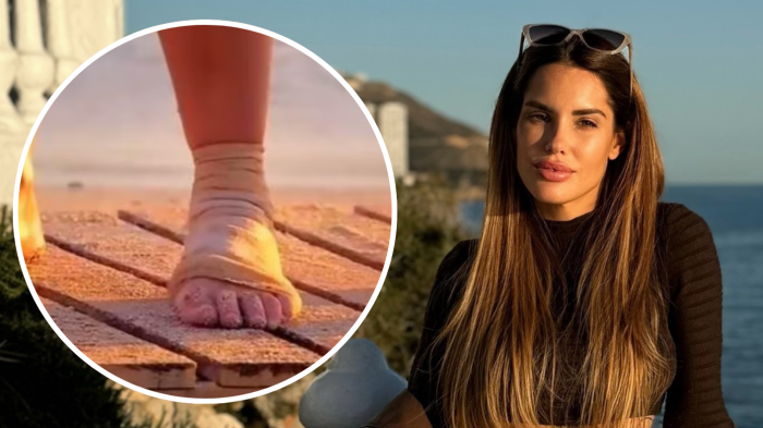 Gala Caldirola sufre lesión en reality show español: “Está con doctores y remedios”