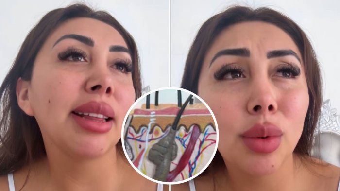 “Parece que tengo...”: El diagnóstico de Naya Fácil que complicó tratamiento estético