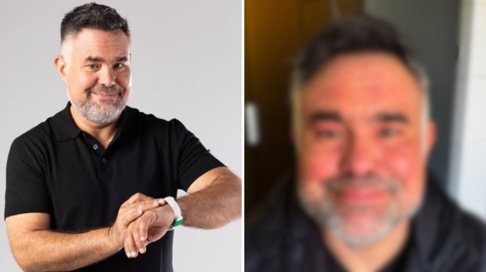 “No tiene cura”: Meteorólogo Gianfranco Marcone reveló que padece enfermedad crónica