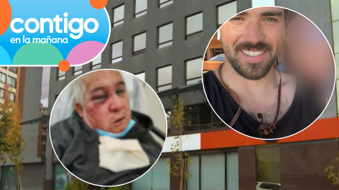 Brutal golpiza a conserje de 70 años: Residente lo pateó en el suelo y quedó con graves secuelas en su ojo