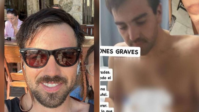 “Sobreviví a una emboscada brutal”: La nueva declaración del hombre acusado de golpear a conserje de 70 años