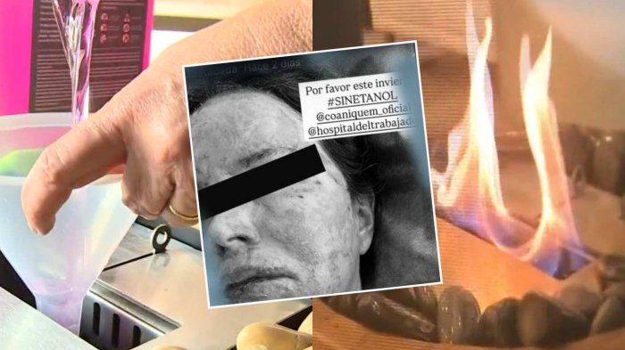 “Invierno sin etanol”: Alertan riesgos y quemaduras por uso de estufas con este compuesto