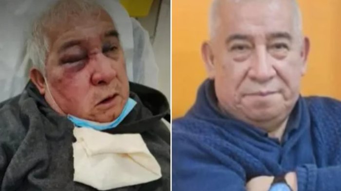 Más grave de lo que pensaban: Actualizan estado de salud de conserje agredido en Vitacura