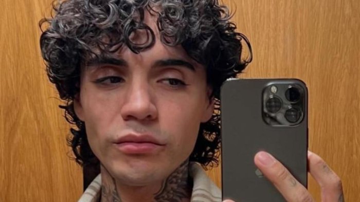 “Por el dolor…”: Leo Méndez Jr. tomó drástica decisión tras su cirugía y sorprendió a seguidores