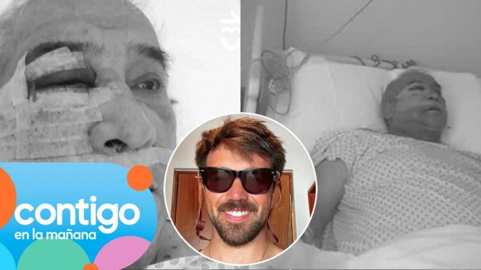 “Estamos destrozados”: Hijo de conserje agredido en Vitacura reveló que su padre perdió la visión de un ojo