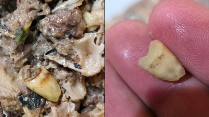 Compró una lata de jurel, reclamó al ver un diente y recibió respuesta: Empresa le ofreció gift card de $5 mil pesos