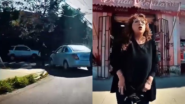 “Tiene costillas fracturadas y está shockeado”: Habla hija de adulto mayor atropellado por conductora que se dio a la fuga